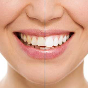 James K Shearer DMD | Night Guards, Emergency Treatment and Oral Exams