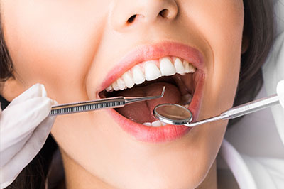 Periodontal Surgery in Whitehall