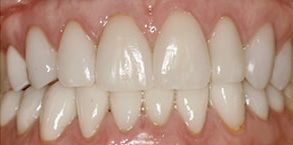 dental images 18052