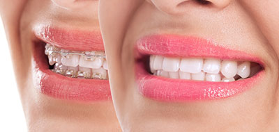 James K Shearer DMD | Oral Exams, Snoring Appliances and Extractions