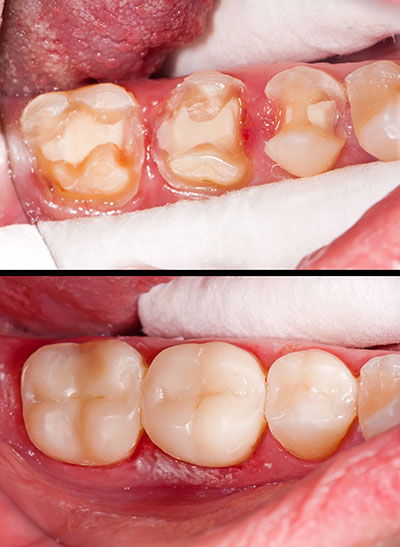 James K Shearer DMD | Sleep Apnea, Emergency Treatment and Implant Dentistry