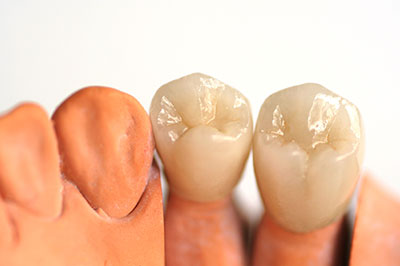 James K Shearer DMD | Cosmetic Dentistry, Digital Radiography and Extractions