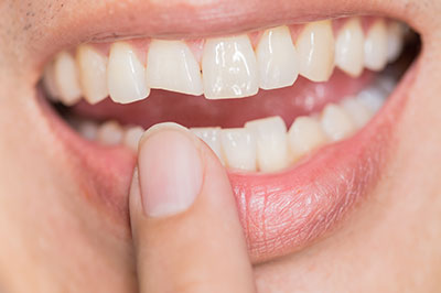 James K Shearer DMD | Pediatric Dentistry, Periodontal Treatment and Ceramic Crowns