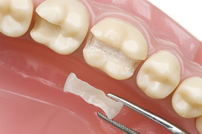 James K Shearer DMD | Oral Cancer Screening, Dental Fillings and Extractions