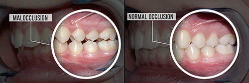 James K Shearer DMD | Emergency Treatment, Implant Dentistry and Cosmetic Dentistry