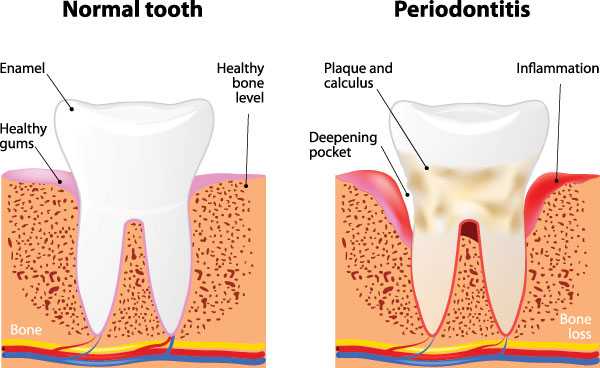 James K Shearer DMD | Teeth Whitening, TMJ Disorders and Pediatric Dentistry