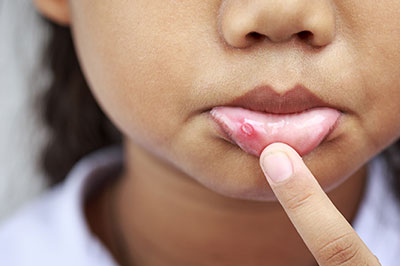 James K Shearer DMD | Preventative Program, Laser Dentistry and Oral Exams