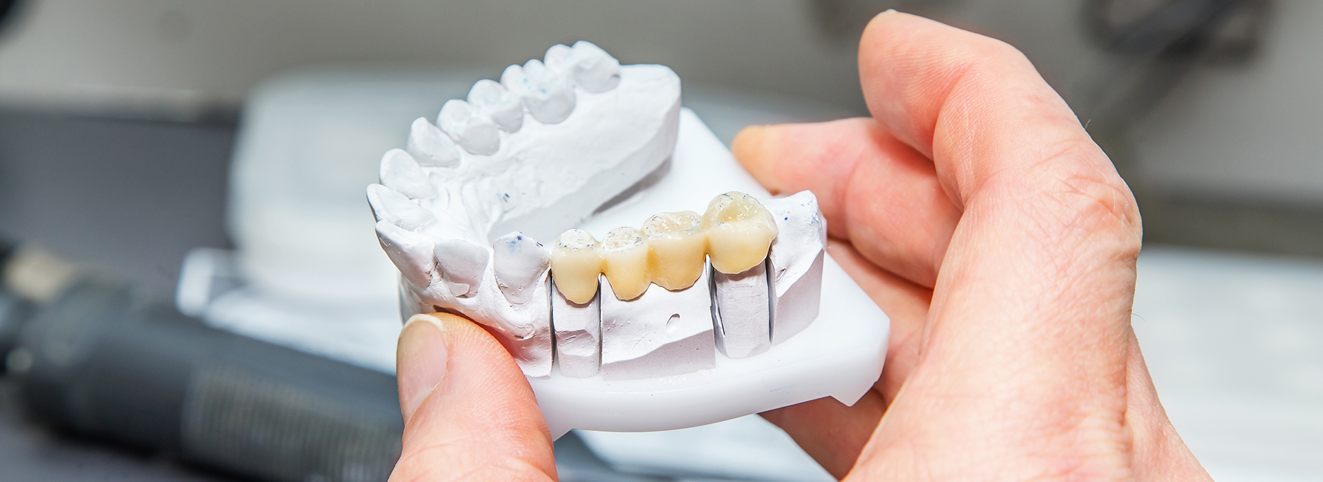 James K Shearer DMD | Periodontal Treatment, Pediatric Dentistry and Dental Fillings