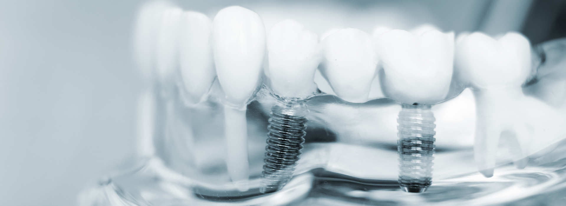 James K Shearer DMD | Teeth Whitening, Oral Cancer Screening and Extractions