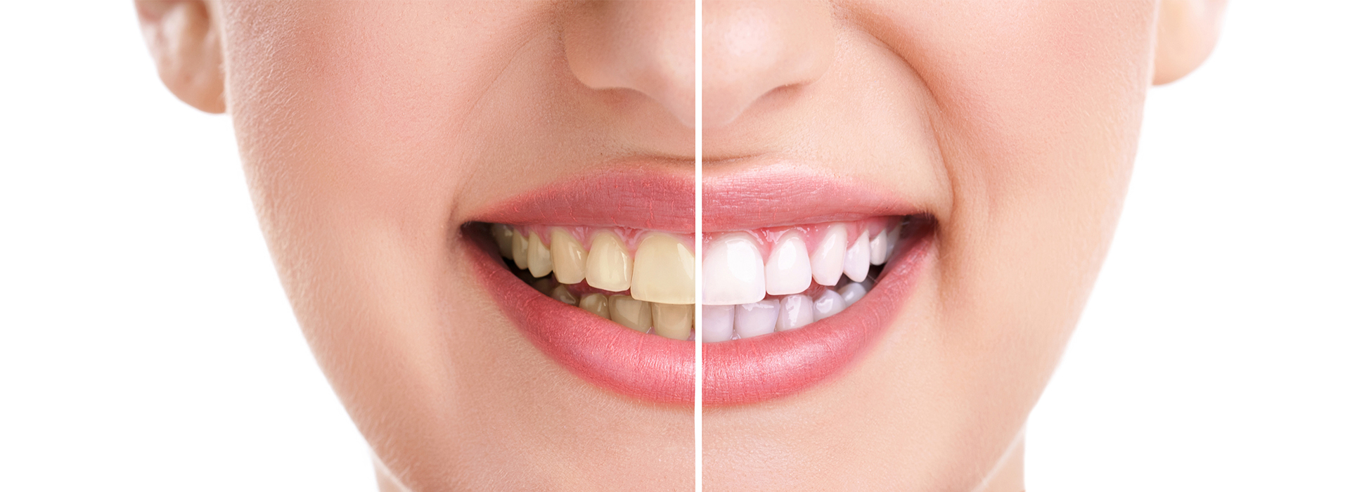James K Shearer DMD | Periodontal Treatment, Preventative Program and Sleep Apnea