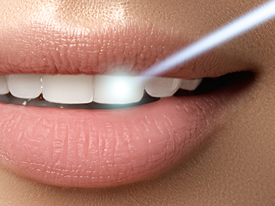 James K Shearer DMD | Dentures, Night Guards and Laser Dentistry